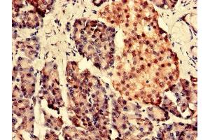 Immunohistochemistry analysis of human pancreatic tissue using ABIN7166460 at dilution of 1:100 (PARK7/DJ1 anticorps  (AA 1-188))