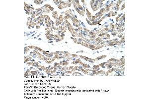 Rabbit Anti-SFRS10 Antibody  Paraffin Embedded Tissue: Human Muscle Cellular Data: Skeletal muscle cells Antibody Concentration: 4. (TRA2B anticorps  (Middle Region))