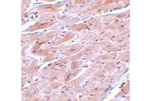 Immunohistochemistry of TRPC3 in mouse heart tissue with TRPC3 polyclonal antibody  at 10 ug/mL . (TRPC3 anticorps  (N-Term))