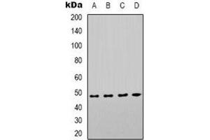 Western blot analysis of COX10 expression in Hela (A), HEK293T (B), mouse kidney (C), mouse brain (D) whole cell lysates. (COX10 anticorps)