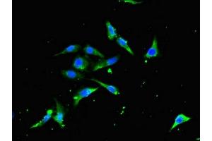 Immunofluorescent analysis of Hela cells using ABIN7172236 at dilution of 1:100 and Alexa Fluor 488-congugated AffiniPure Goat Anti-Rabbit IgG(H+L)