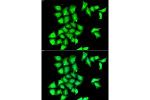Immunofluorescence analysis of HeLa cells using MSRB1 antibody (ABIN5974074). (MSRB1 anticorps)