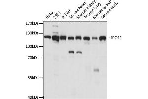 Western blot analysis of extracts of various cell lines, using IPO11 antibody (ABIN7267854) at 1:1000 dilution. (Importin 11 anticorps  (AA 776-975))