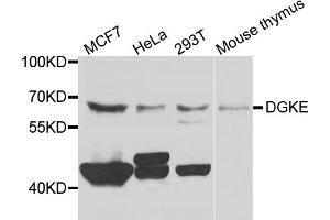 Western blot analysis of extracts of various cell lines, using DGKE antibody. (DGKE anticorps)