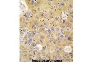 Immunohistochemistry (IHC) image for anti-Alanyl-tRNA Synthetase 2, Mitochondrial (AARS2) antibody (ABIN3003290) (AARS2 anticorps)