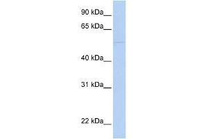 WB Suggested Anti-PRF1 Antibody Titration:  0. (Perforin 1 anticorps  (N-Term))