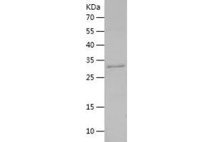Western Blotting (WB) image for Transforming Growth Factor, beta 1 (TGFB1) (AA 30-278) protein (His tag) (ABIN7125457)