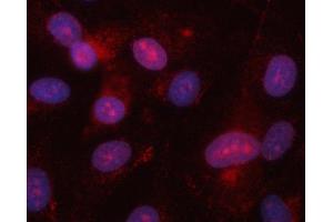 IF analysis of EIF2AK1 using anti-EIF2AK1 antibody (ABIN7601508). (EIF2AK1 anticorps  (AA 37-508))