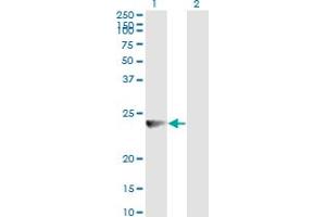Western Blot analysis of RAB7B expression in transfected 293T cell line by RAB7B monoclonal antibody (M01), clone 3B3.