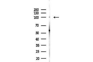 anti-phosphodiesterase 6A, CGMP-Specific, Rod, alpha (PDE6A) (N-Term) antibody