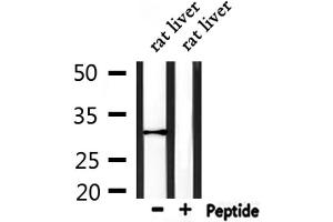 Western blot analysis of extracts from rat liver, using VTCN1 Antibody.