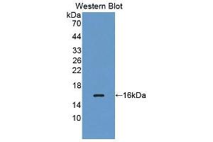 Western blot analysis of the recombinant protein. (MARS anticorps  (AA 74-198))