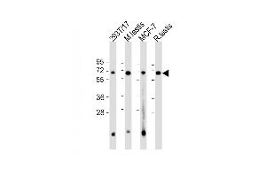 All lanes : Anti-FEM1B Antibody (C-Term) at 1:2000 dilution Lane 1: 293T/17 whole cell lysate Lane 2: mouse testis lysate Lane 3: MCF-7 whole cell lysate Lane 4: rat testis lysate Lysates/proteins at 20 μg per lane. (FEM1B anticorps  (AA 547-579))