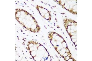 Immunohistochemistry of paraffin-embedded human colon using PCNA antibody. (PCNA anticorps  (AA 1-261))