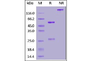 Anti-SARS-CoV-2 Spike RBD Antibody, Chimeric mAb, Human IgG1 (ABIN6953206) on SDS-PAGE under reducing (R) and non-reducing (NR) conditions. (SARS-CoV-2 Spike S1 anticorps)