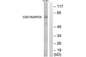 Western Blotting (WB) image for anti-Cell Division Cycle 16 Homolog (S. Cerevisiae) (CDC16) (AA 526-575) antibody (ABIN2888871) (CDC16 anticorps  (AA 526-575))