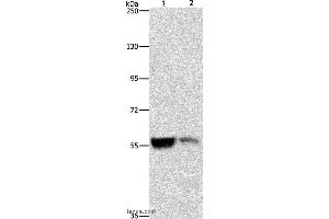 Western blot analysis of Mouse liver and kidney tissue, using ALDH8A1 Polyclonal Antibody at dilution of 1:550 (ALDH8A1 anticorps)