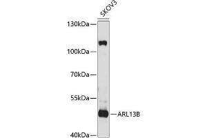 Western blot analysis of extracts of SKOV3 cells, using B antibody (ABIN6130859, ABIN6137109, ABIN6137110 and ABIN6220869) at 1:1000 dilution. (ARL13B anticorps  (AA 1-240))
