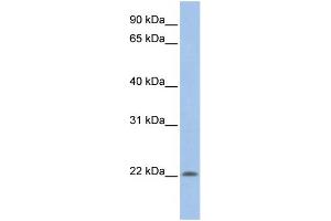 WB Suggested Anti-UBE2M  Antibody Titration: 0.