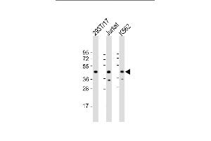 All lanes : Anti-PHF6 Antibody (Center) at 1:2000 dilution Lane 1: 293T/17 whole cell lysate Lane 2: Jurkat whole cell lysate Lane 3: K562 whole cell lysate Lysates/proteins at 20 μg per lane. (PHF6 anticorps  (AA 148-180))
