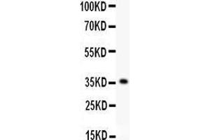 Anti- KLF6 antibody, Western blotting All lanes: Anti KLF6  at 0.