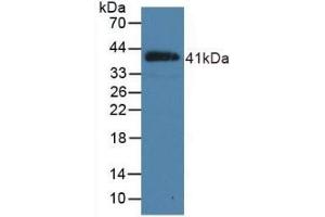 Detection of Recombinant NPPB, Porcine using Polyclonal Antibody to Natriuretic Peptide Precursor B (NPPB)