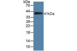 Detection of Recombinant NPPB, Porcine using Polyclonal Antibody to Natriuretic Peptide Precursor B (NPPB) (NPPB anticorps  (AA 26-131))