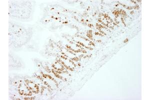Immunohistochemistry (IHC) image for anti-Antigen Identified By Monoclonal Antibody Ki-67 (MKI67) (AA 1650-1700) antibody (ABIN7448620)