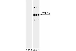 Western blot analysis of SLP-76 (pY113) in human T leukemia. (LCP2 anticorps  (pTyr113))