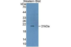Figure. (UXT anticorps  (AA 11-157))
