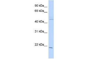 WB Suggested Anti-CIB3 Antibody Titration: 0. (CIB3 anticorps  (N-Term))