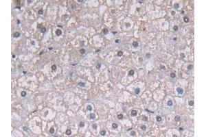 Detection of PGK1 in Human Liver Tissue using Polyclonal Antibody to Phosphoglycerate Kinase 1 (PGK1)