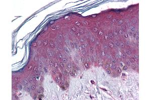 Anti-CORO1C / Coronin 3 antibody IHC of human skin.