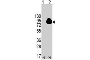 Western blot analysis of RPS6KA1 (arrow) using RPS6KA1 polyclonal antibody . (RPS6KA1 anticorps  (Ser732))