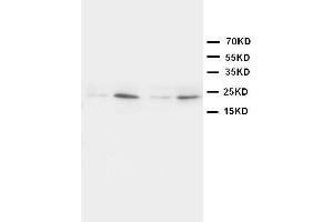 Anti-HMGB4 antibody, Western blotting Lane 1: Rat Brain Tissue Lysate Lane 2: Rat Testis Tissue Lysate Lane 3: JURKAT Cell Lysate Lane 4:  Cell Lysate (HMGB4 anticorps  (N-Term))