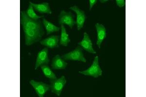 Immunofluorescence analysis of A549 cell using CDC5L antibody. (CDC5L anticorps)