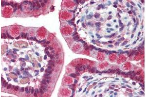 Human Small Intestine042998.