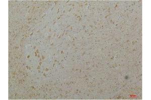 Immunohistochemistry (IHC) analysis of paraffin-embedded Mouse Brain Tissue using Cav1. (CACNA1D anticorps)