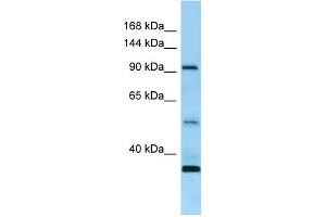 Western Blotting (WB) image for anti-Receptor Tyrosine Kinase-Like Orphan Receptor 1 (ROR1) (N-Term) antibody (ABIN2789669) (ROR1 anticorps  (N-Term))