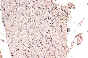 Immunohistochemistry of paraffin-embedded rat brain using HSPE1/HSP10/HSPE1/HSP10/CPN10 Rabbit mAb (ABIN7267567) at dilution of 1:100 (40x lens).