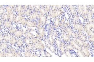 Detection of ANG in Rat Kidney Tissue using Polyclonal Antibody to Angiogenin (ANG) (ANG anticorps  (AA 25-142))