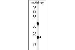 U119B Antibody (C-term) (ABIN654979 and ABIN2844619) western blot analysis in mouse kidney tissue lysates (35 μg/lane). (UNC119B anticorps  (C-Term))