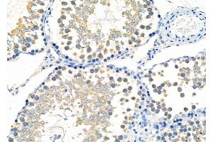 ABIN6261296 and ABIN6277276 at 1/100 staining Rat testis tissue by IHC-P.