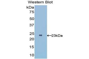 Detection of Recombinant IL1RL1, Human using Polyclonal Antibody to Interleukin 1 Receptor Like Protein 1 (IL1RL1) (IL1RL1 anticorps  (AA 162-349))