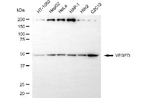 Western blotting analysis using VEGFD antibody (ABIN7797811).