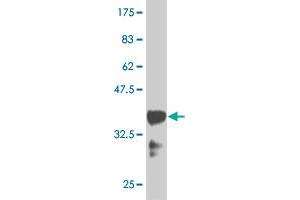 Western Blot detection against Immunogen (36. (HOXB9 anticorps  (AA 65-163))