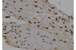 ABIN6276493 at 1/100 staining Human gastric tissue by IHC-P. (NUAK2 anticorps  (Internal Region))