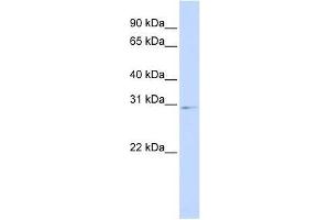 Western Blot showing HOXA9 antibody used at a concentration of 1-2 ug/ml to detect its target protein.