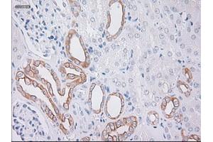 Immunohistochemistry (IHC) image for anti-Keratin 19 (KRT19) (AA 240-390) antibody (ABIN1491259) (Cytokeratin 19 anticorps  (AA 240-390))
