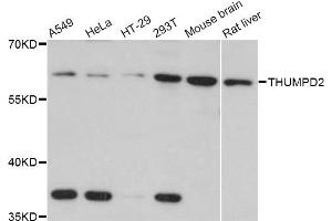 Western blot analysis of extracts of various cell lines, using THUMPD2 Antibody (ABIN4905417) at 1:3000 dilution. (THUMPD2 anticorps)